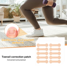 150pcs Ingrown Toenail Strips, Breathable Ingrown Toenail Corrector Strips Painless Toenail Corrector Tool Non-Woven Ingrown Nail Stickers for Professional Pedicure Accessories