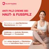 Clotrimazole AL 1% Cream 50 g, 50 g