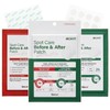 Skinae Acwin Spot Care Multi-Patch Set 5 Large Capacity (152