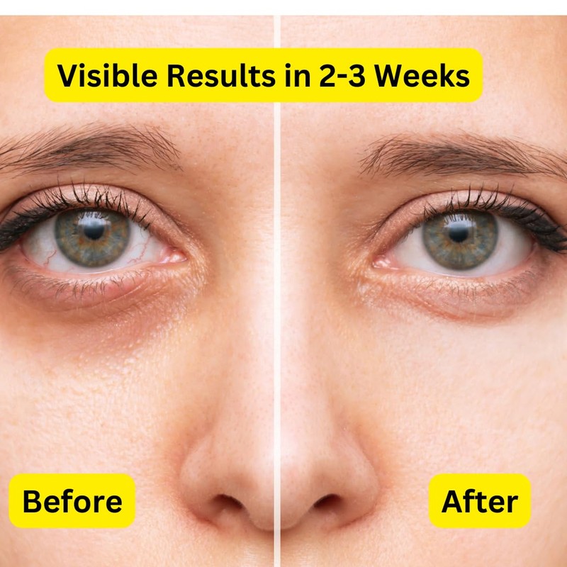 Prime9 Eye Cream for Dark Circles and Puffy Eyes| 60ml/2.02