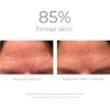 Derma-E Ferulic Acid Resurfacing Pads Unisex Pads 1.7 oz