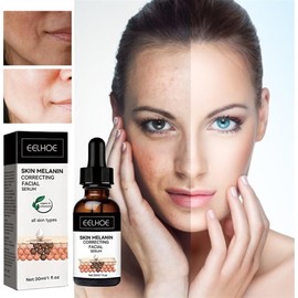 Melanin Repair Freckle Removing Brightening Facial Essence，Moisturize and Repair Dull, White and Tender Skin. (Color : 2pcs)
