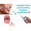 Power floss Irrigador Bucal Limpieza Brackets Eliminación Tonsilolito