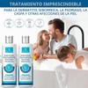 Roycederm Champú para la psoriasis, dermatitis seborreica, foliculitis y caspa,