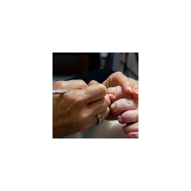 Meticulous Manicurist Ingrown Toenail Sidewall Rasp