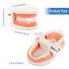 Dental Model 2 Pieces Children's Teeth Model Dental Care Model