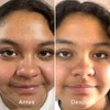 Serum Facial Piel Grasa, Oil Control, NIACINAMIDA (vit B3), Noni,