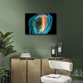 Office Wall Art Human Spine X-Ray Large Canvas Wall Art Back Muscles Bones Contemporary Modern Artwork 3D Spine Pictures Wall Art for Nurse Physicians Assistant Framed Ready to Hang - 12" Wx18 H