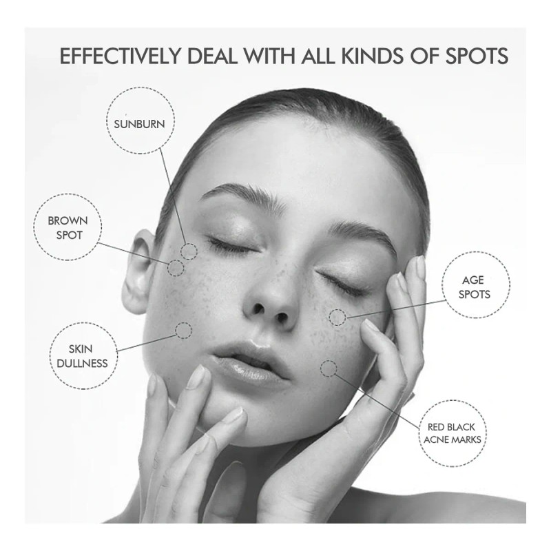 Crema Para Eliminar Manchas Oscuras Y Manchas Para Melasma Y
