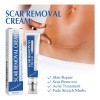 2 Cremas Para Cicatrices, Gel De Silicona Para Cicatrices,