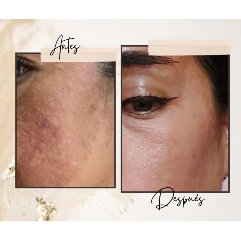 Crema Despigmentante Artesanal Orgánica