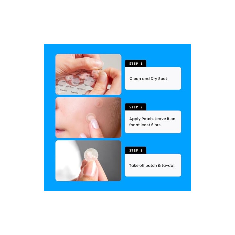 Avarelle Acne Cover Spot Patch Hydrocolloid, Tea Tree & Calendula