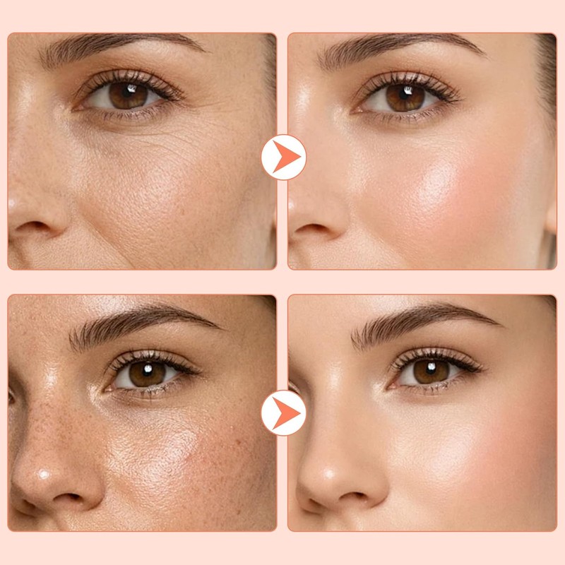 Sérum Facial Salmón PDRN Peptide, para Imperfecciones, Colágeno y Líneas(1)