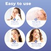KEYCONCEPTS Patchrx Parches De Espinillas Para La Cara (240 Parches),