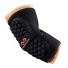 McDavid Handball Ellbogenschützer 672, black, x-small