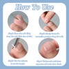 Pack of 150 Nail Clips Toenails, Ingrown Toenail Correction, Nail