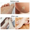 LUPO Foot Callus Rasp File Pedicure Hard Dead Skin Remover