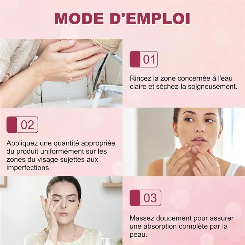 Sérum De Ácido Azelaico 20 G, Reduce Las Imperfecciones