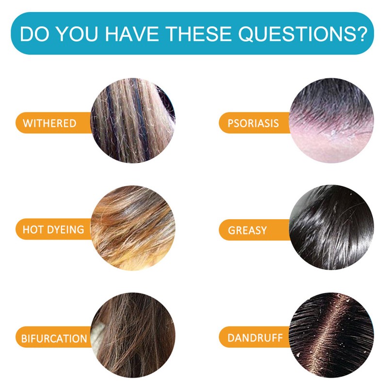 200ml Dandruff Shampoo Sea Salt Shampoo for Itching Scalp and