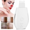 Household Ultrasonic Skin Scrubber EMS MicroCurrent Blackhead Removal Face Pore