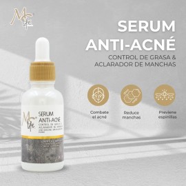 Serum Antiacn 30ml Mc Life Control Grasa Aclara Manchas Rostro