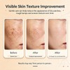 Eczema Cream 20g，Soothes Itchy, Gentle and Relieves Itching, for Dermatitis