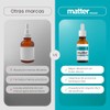 Matter Desol Vitamina Colecalciferol Gotas Apoyo Absorción Calcio Bienestar Celular