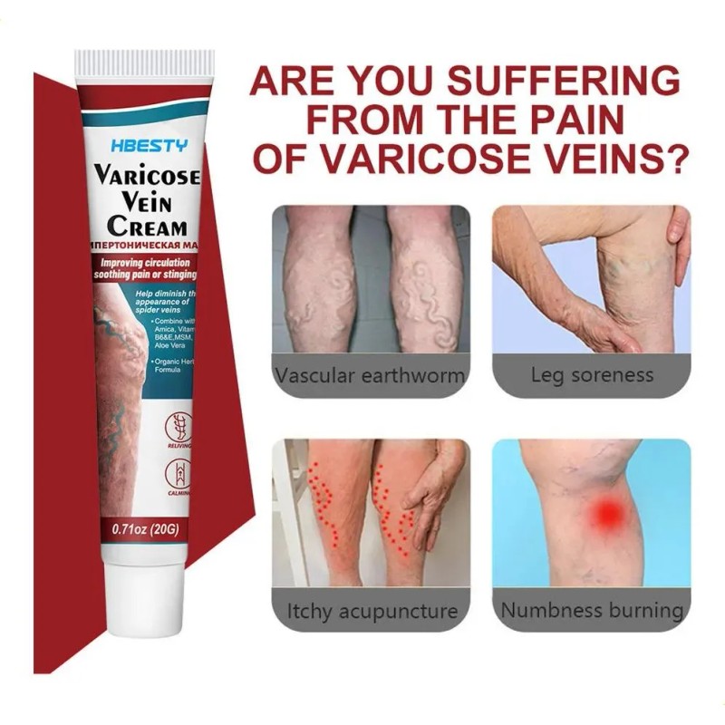 Crema Varicoso Contra Varices De 3 Piezas Para Fortalecer La
