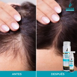 Tratamiento anticaída, Crecimiento y Fortalecimiento dúo Shampoo y loción con extracto de Caviar Biomimético
