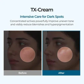 Crema De Ácido Tranexámico Tx Jmghj .