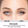 Dermactin-TS Dermactin Anti-Aging Dark Circles Puffiness Eye Cream 1 oz.