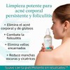 Body Clearing Serum Level 2 - Advanced formula for severe