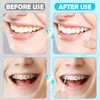 MAPVOLUT 120 Pieces Interdental Brushes, Braces Brush Cleaner Orthodontic Flossers