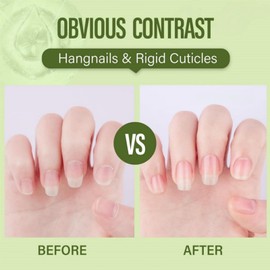 15ml Rose Nail Cuticle Oil,Nail Oil,Na-Il Oil For Growth And Strength,Nourishing Cuticle O-Il&Growth Improve For Na-Ils&Toenails,For Dry Cut-Icles Hydrates And Moisturizes With Real Flowers(Rose)