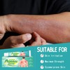 Crema Para Psoriasis Y Eczema, Crema Natural A Base De