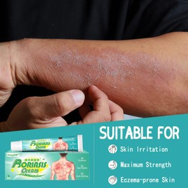 Crema Para Psoriasis Y Eczema, Crema Natural A Base De Hierbas Antipicazón, Cremas Hidratante Para Piel Seca, Con Picazón, Picaduras, Erupciones (Paquete de 5)