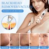 Bwaliffury Mitesserentferner Porenreiniger Porensauger, Blackhead Remover, Mitesser Entferner 5 Modi