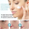 Tkekruh Dark Spot Remover for Face