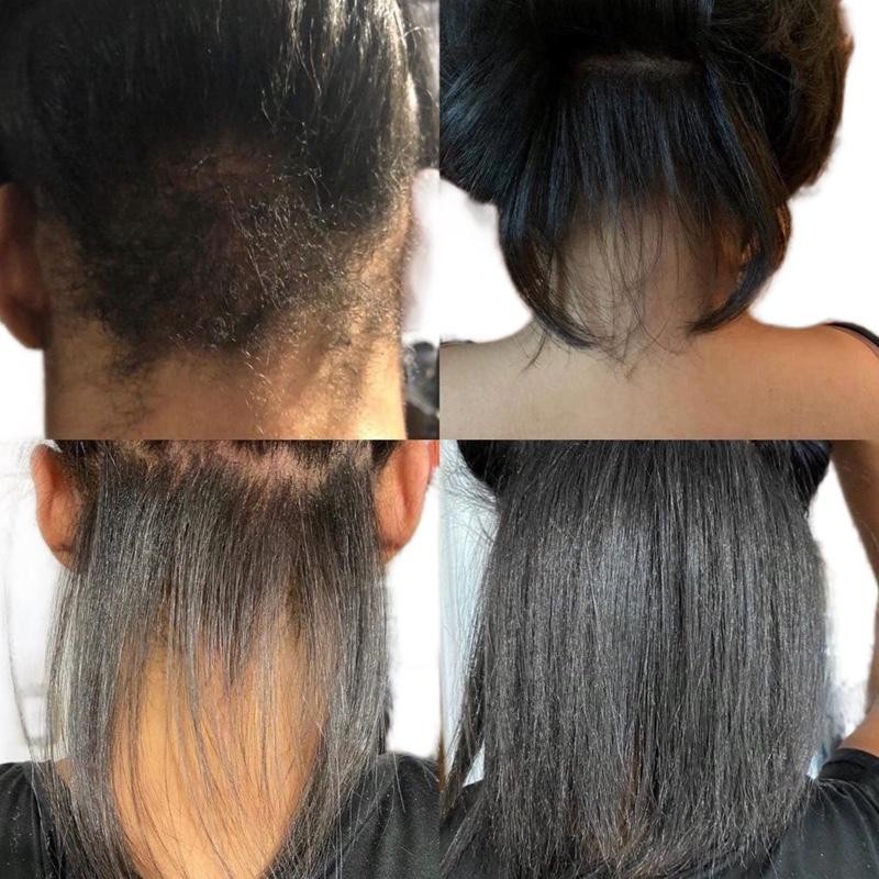 EXTRA STRENGTH HAIR GROWTH OIL