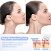 Yofuly High Frequency Face Wand, Portable High Frequency Facial Machine