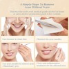 BESTOPE PRO Blackhead Remover, 6 Pieces Acne Remover Set -