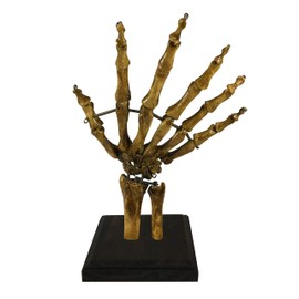 Asylum Zone Bizarre! Vintage 6 Finger Skeleton Hand Oddity Medical Specimen