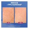 Nivea Luminous 630 Sérum Facial Anti-Manchas e Imperfecciones, 30 ml
