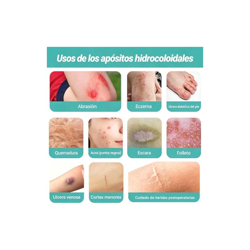 Cinta Hidrocoloide Rollo 2PCS, Parches Hidrocoloides para Cuidado de Heridas,