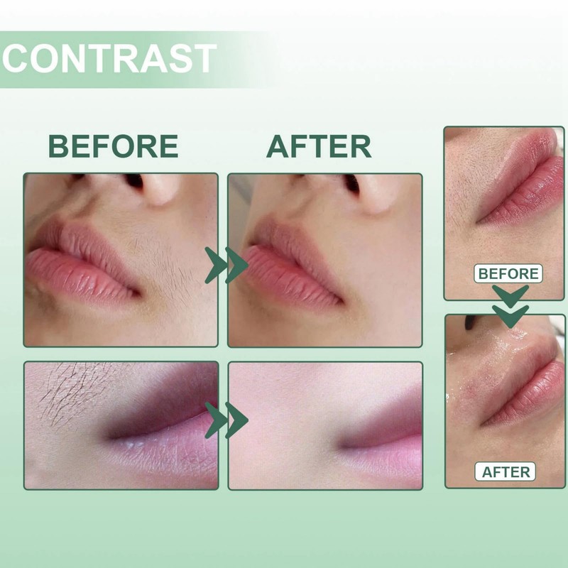 Facial Hair Removal Cream,Natural Facial Hair Remover Cream,Gentle Upper Lip