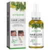 Hair Loss Treatment Serum. Reduces Hair Loss. Increases Hair Density.,