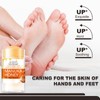60% Urea Cream, Honey Foot Cream, 2PCS New Foot Cream
