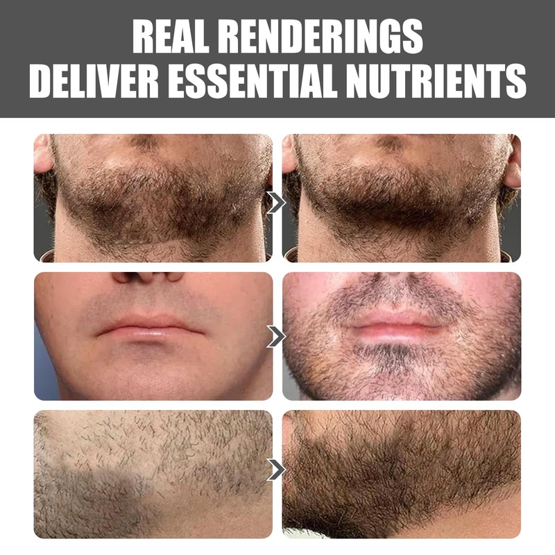 Beard Growth Kit with Rollers Beard Growth Agent Men Black