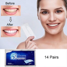 iZhuoKe 28 Pieces Teeth Whitening Strips,Teeth Whitening,Professional Teeth Stain Removal,Whiten Teeth