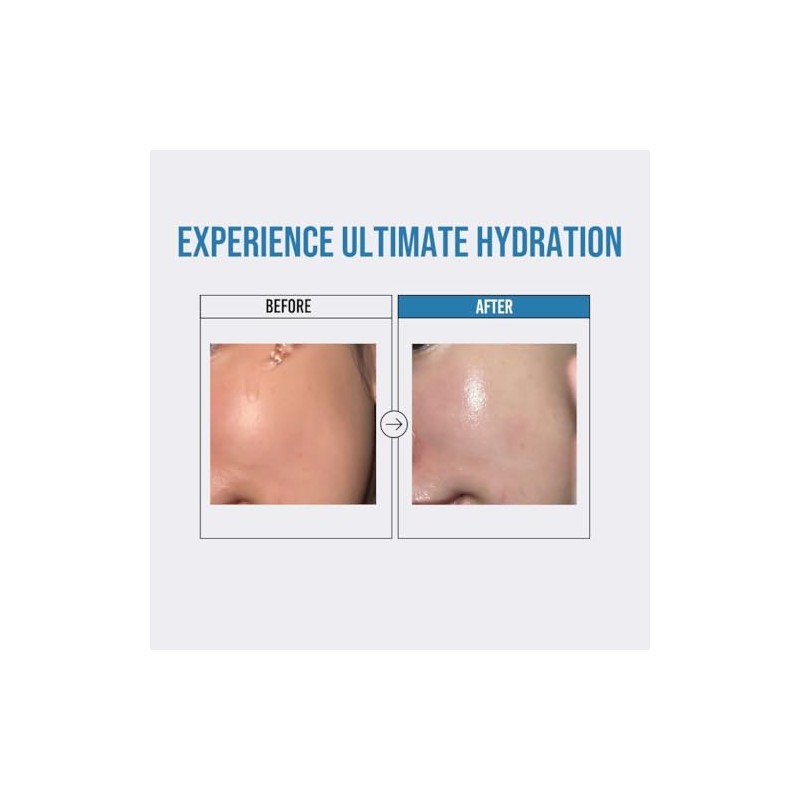 [Jumiso] Waterfull Hyaluronic Acid Serum 50ml